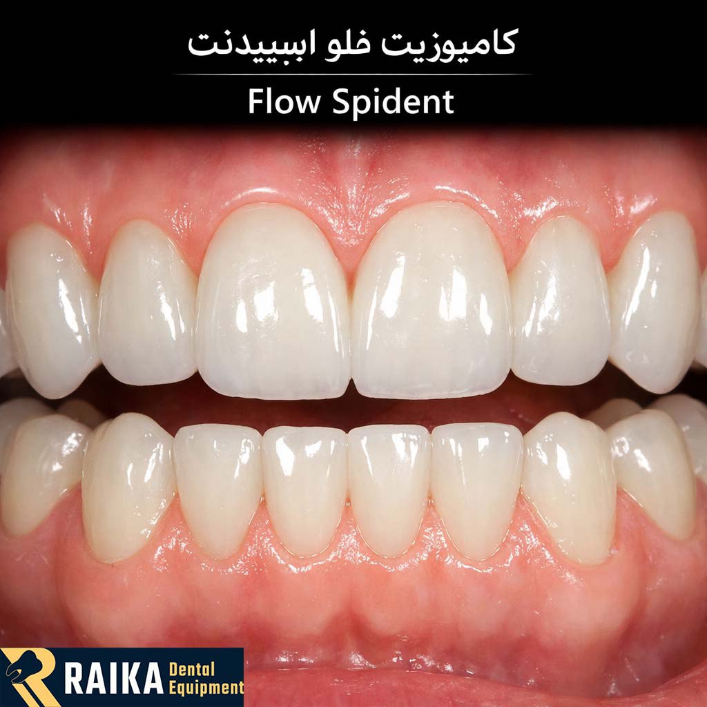 نمونه کار کامپوزیت فلو اسپیدنت