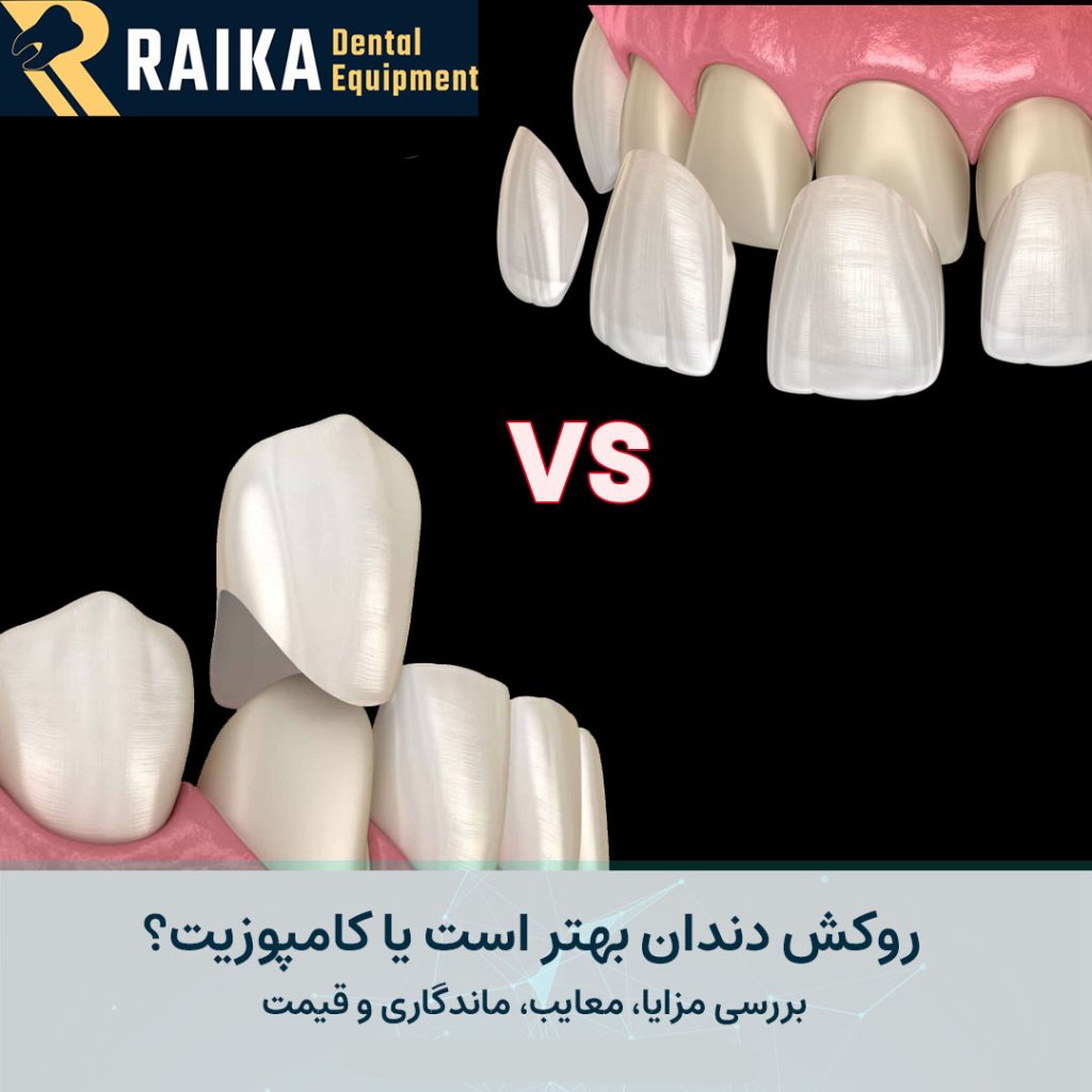 تفاوت روکش دندان و کامپوزیت