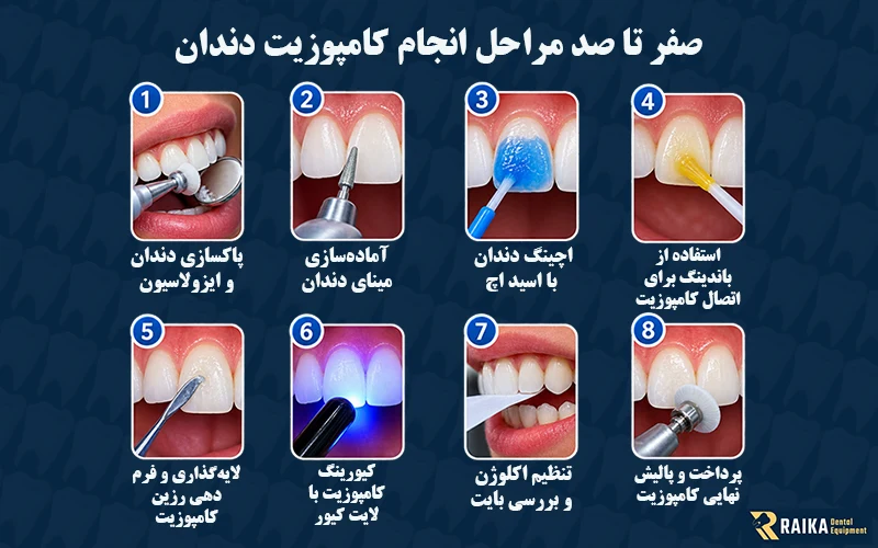 صفر تا صد مراحل انجام کامپوزیت دندان